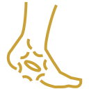 Gold line icon of a foot and ankle highlighting joint pain, swelling, or localized inflammation with a broken circular symbol